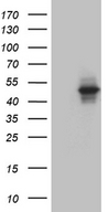 AGPAT9 / MAG1 Antibody - HEK293T cells were transfected with the pCMV6-ENTRY control. (Left lane) or pCMV6-ENTRY AGPAT9. (Right lane) cDNA for 48 hrs and lysed. Equivalent amounts of cell lysates. (5 ug per lane) were separated by SDS-PAGE and immunoblotted with anti-AGPAT9. (1:2000)