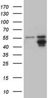 AGPAT9 / MAG1 Antibody - HEK293T cells were transfected with the pCMV6-ENTRY control. (Left lane) or pCMV6-ENTRY AGPAT9. (Right lane) cDNA for 48 hrs and lysed. Equivalent amounts of cell lysates. (5 ug per lane) were separated by SDS-PAGE and immunoblotted with anti-AGPAT9. (1:500)