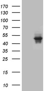 AGPAT9 / MAG1 Antibody - HEK293T cells were transfected with the pCMV6-ENTRY control. (Left lane) or pCMV6-ENTRY AGPAT9. (Right lane) cDNA for 48 hrs and lysed. Equivalent amounts of cell lysates. (5 ug per lane) were separated by SDS-PAGE and immunoblotted with anti-AGPAT9. (1:2000)