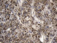 AGPAT9 / MAG1 Antibody - Immunohistochemical staining of paraffin-embedded Human liver tissue within the normal limits using anti-AGPAT9 mouse monoclonal antibody. (Heat-induced epitope retrieval by 1mM EDTA in 10mM Tris buffer. (pH8.5) at 120°C for 3 min. (1:500)