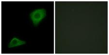 AGPAT9 / MAG1 Antibody - Immunofluorescence analysis of HepG2 cells, using PLCH Antibody. The picture on the right is blocked with the synthesized peptide.
