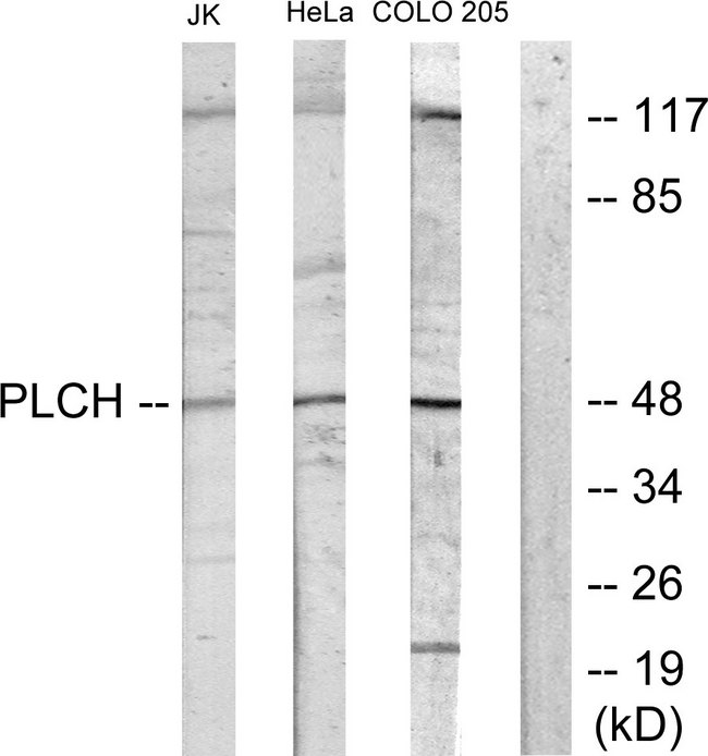 AGPAT9 / MAG1 Antibody - Western blot analysis of lysates from Jurkat cells, COLO205 cells, HeLa cells, and HUVEC cells, using PLCH Antibody. The lane on the right is blocked with the synthesized peptide.