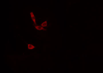 AGPAT9 / MAG1 Antibody - Staining HeLa cells by IF/ICC. The samples were fixed with PFA and permeabilized in 0.1% Triton X-100, then blocked in 10% serum for 45 min at 25°C. The primary antibody was diluted at 1:200 and incubated with the sample for 1 hour at 37°C. An Alexa Fluor 594 conjugated goat anti-rabbit IgG (H+L) antibody, diluted at 1/600, was used as secondary antibody.