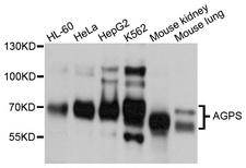 AGPS Antibody - Western blot analysis of extracts of various cell lines, using AGPS antibody at 1:1000 dilution. The secondary antibody used was an HRP Goat Anti-Rabbit IgG (H+L) at 1:10000 dilution. Lysates were loaded 25ug per lane and 3% nonfat dry milk in TBST was used for blocking. An ECL Kit was used for detection and the exposure time was 5s.