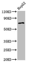 AGPS Antibody - Positive Western Blot detected in HepG2 whole cell lysate. All lanes: AGPS antibody at 2.7 µg/ml Secondary Goat polyclonal to rabbit IgG at 1/50000 dilution. Predicted band size: 73 KDa. Observed band size: 73 KDa