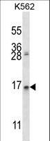 AGR2 Antibody - AGR2 Antibody western blot of K562 cell line lysates (35 ug/lane). The AGR2 antibody detected the AGR2 protein (arrow).
