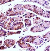 AGR2 Antibody - AGR2 Antibody immunohistochemistry of formalin-fixed and paraffin-embedded human stomach tissue followed by peroxidase-conjugated secondary antibody and DAB staining.