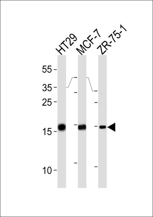 AGR2 Antibody - AGR2 Antibody western blot of HT29,MCF-7,ZR-75-1 cell line lysates (35 ug/lane). The AGR2 antibody detected the AGR2 protein (arrow).