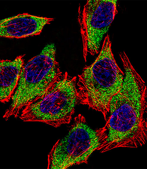 AGR2 Antibody - Fluorescent confocal image of A549 cell stained with AGR2 Antibody. A549 cells were fixed with 4% PFA (20 min), permeabilized with Triton X-100 (0.1%, 10 min), then incubated with AGR2 primary antibody (1:25, 1 h at 37°C). For secondary antibody, Alexa Fluor 488 conjugated donkey anti-rabbit antibody (green) was used (1:400, 50 min at 37°C). Cytoplasmic actin was counterstained with Alexa Fluor 555 (red) conjugated Phalloidin (7units/ml, 1 h at 37°C). Nuclei were counterstained with DAPI (blue) (10 ug/ml, 10 min). AGR2 immunoreactivity is localized to Cytoplasm significantly.