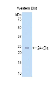 AGR2 Antibody - Western blot of recombinant AGR2.  This image was taken for the unconjugated form of this product. Other forms have not been tested.