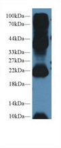 AGR2 Antibody - Western Blot; Sample: Mouse Testis lysate; Primary Ab: 2µg/ml Rabbit Anti-Human AGR2 Antibody Second Ab: 0.2µg/mL HRP-Linked Caprine Anti-Rabbit IgG Polyclonal Antibody