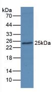 AGR2 Antibody - Western Blot; Sample: Human MCF7 Cells.