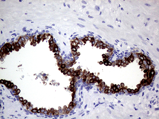 AGR2 Antibody - Immunohistochemical staining of paraffin-embedded Human prostate tissue within the normal limits using anti-AGR2 mouse monoclonal antibody. (Heat-induced epitope retrieval by 1mM EDTA in 10mM Tris buffer. (pH8.5) at 120°C for 3 min. (1:500)