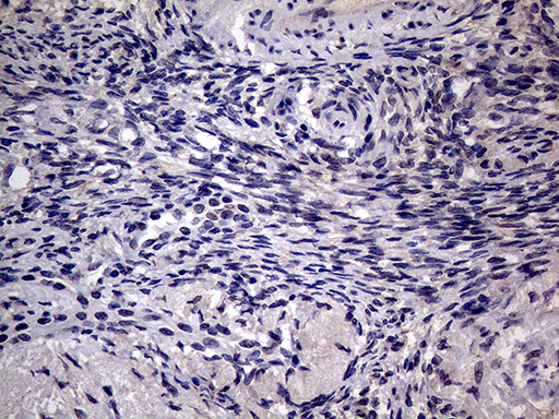 AGR2 Antibody - Immunohistochemical staining of paraffin-embedded Human Ovary tissue within the normal limits using anti-AGR2 mouse monoclonal antibody. This figure shows negative staining. (Heat-induced epitope retrieval by 1mM EDTA in 10mM Tris buffer. (pH8.5) at 120°C for 3 min. (1:500)
