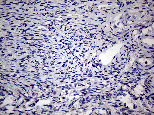 AGR2 Antibody - Immunohistochemical staining of paraffin-embedded Human Ovary tissue within the normal limits using anti-AGR2 mouse monoclonal antibody. This figure shows negative staining. (Heat-induced epitope retrieval by 1mM EDTA in 10mM Tris buffer. (pH8.5) at 120°C for 3 min. (1:500)