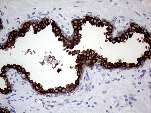 AGR2 Antibody - Immunohistochemical staining of paraffin-embedded Human prostate tissue within the normal limits using anti-AGR2 mouse monoclonal antibody. (Heat-induced epitope retrieval by 1mM EDTA in 10mM Tris buffer. (pH8.5) at 120°C for 3 min. (1:500)