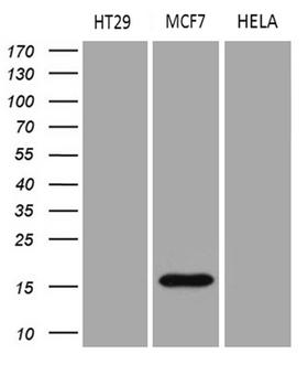 AGR2 Antibody - Western blot analysis of extracts. (35ug) from 3different cell lines by using anti-AGR2 monoclonal antibody?(1:500)