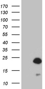 AGR2 Antibody - HEK293T cells were transfected with the pCMV6-ENTRY control. (Left lane) or pCMV6-ENTRY AGR2. (Right lane) cDNA for 48 hrs and lysed. Equivalent amounts of cell lysates. (5 ug per lane) were separated by SDS-PAGE and immunoblotted with anti-AGR2. (1:500)