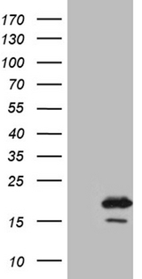 AGR2 Antibody - HEK293T cells were transfected with the pCMV6-ENTRY control. (Left lane) or pCMV6-ENTRY AGR2. (Right lane) cDNA for 48 hrs and lysed. Equivalent amounts of cell lysates. (5 ug per lane) were separated by SDS-PAGE and immunoblotted with anti-AGR2. (1:2000)