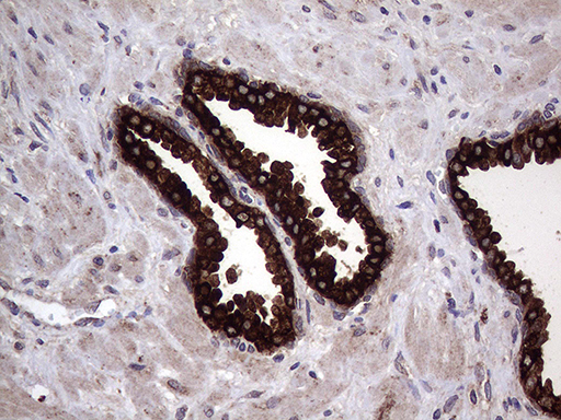 AGR2 Antibody - Immunohistochemical staining of paraffin-embedded Human prostate tissue within the normal limits using anti-AGR2 mouse monoclonal antibody. (Heat-induced epitope retrieval by 1mM EDTA in 10mM Tris buffer. (pH8.5) at 120°C for 3 min. (1:2000)