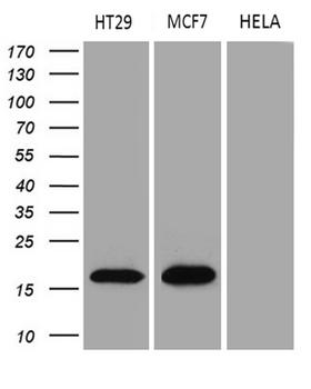 AGR2 Antibody - Western blot analysis of extracts. (35ug) from 3 different cell lines by using anti-AGR2 monoclonal antibody. (1:500)