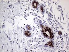 AGR2 Antibody - Immunohistochemical staining of paraffin-embedded Human breast tissue within the normal limits using anti-AGR2 mouse monoclonal antibody. (Heat-induced epitope retrieval by 1mM EDTA in 10mM Tris buffer. (pH8.5) at 120°C for 3 min. (1:2000)