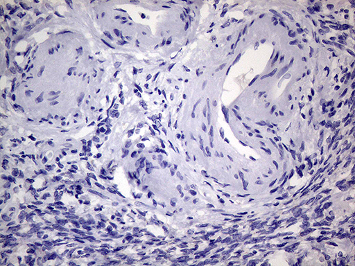 AGR2 Antibody - Immunohistochemical staining of paraffin-embedded Human Ovary tissue within the normal limits using anti-AGR2 mouse monoclonal antibody.This figure shows negative staining. (Heat-induced epitope retrieval by 1mM EDTA in 10mM Tris buffer. (pH8.5) at 120°C for 3 min. (1:2000)