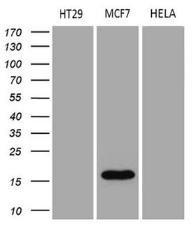 AGR2 Antibody - Western blot analysis of extracts. (35ug) from 3 different cell lines by using anti-AGR2 monoclonal antibody. (1:500)