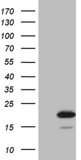 AGR2 Antibody - HEK293T cells were transfected with the pCMV6-ENTRY control. (Left lane) or pCMV6-ENTRY AGR2. (Right lane) cDNA for 48 hrs and lysed. Equivalent amounts of cell lysates. (5 ug per lane) were separated by SDS-PAGE and immunoblotted with anti-AGR2. (1:2000)