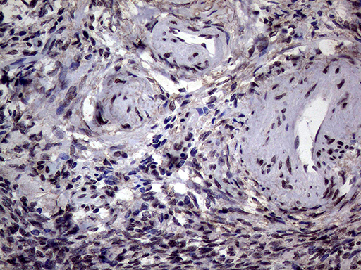 AGR2 Antibody - Immunohistochemical staining of paraffin-embedded Human Ovary tissue within the normal limits using anti-AGR2 mouse monoclonal antibody. (Heat-induced epitope retrieval by 1mM EDTA in 10mM Tris buffer. (pH8.5) at 120°C for 3 min. (1:2000)