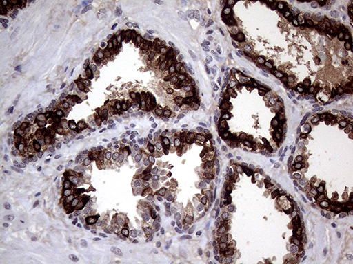 AGR2 Antibody - Immunohistochemical staining of paraffin-embedded Human prostate tissue within the normal limits using anti-AGR2 mouse monoclonal antibody. (Heat-induced epitope retrieval by 1mM EDTA in 10mM Tris buffer. (pH8.5) at 120°C for 3 min. (1:2000)