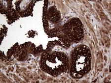 AGR2 Antibody - Immunohistochemical staining of paraffin-embedded Human prostate tissue within the normal limits using anti-AGR2 mouse monoclonal antibody. (Heat-induced epitope retrieval by 1mM EDTA in 10mM Tris buffer. (pH8.5) at 120°C for 3 min. (1:2000)