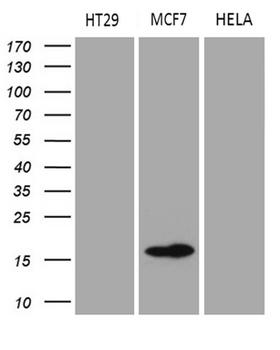 AGR2 Antibody - Western blot analysis of extracts. (35ug) from 3 different cell lines by using anti-AGR2 monoclonal antibody. (1:500)