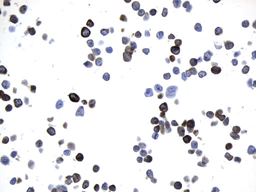 AGR2 Antibody - Immunohistochemical staining of paraffin-embedded T-47D cell pellets using anti-AGR2 mouse monoclonal antibody. (Heat-induced epitope retrieval by 1mM EDTA in 10mM Tris buffer. (pH8.0) at 120°C for 2.5 min. (1:500)