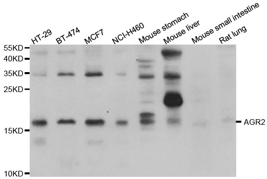 AGR2 Antibody - Western blot analysis of extracts of various cell lines.