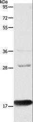 AGR2 Antibody - Western blot analysis of Mouse Large intestine tissue, using AGR2 Polyclonal Antibody at dilution of 1:1000.