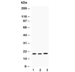 AGR2 Antibody - Western blot testing of 1) rat lung, 2) mouse liver and 3) human MCF7 lysate with AGR2 antibody at 0.5ug/ml. Predicted molecular weight ~20 kDa.