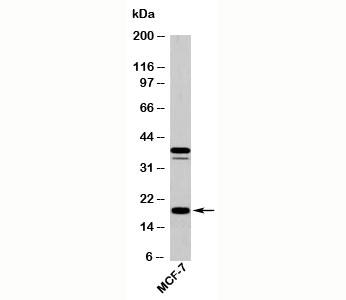 AGR2 Antibody - AGR2 antibody western blot of human samples