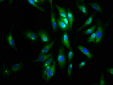 AGRN / Agrin Antibody - Immunofluorescence staining of Hela cells at a dilution of 1:133, counter-stained with DAPI. The cells were fixed in 4% formaldehyde, permeabilized using 0.2% Triton X-100 and blocked in 10% normal Goat Serum. The cells were then incubated with the antibody overnight at 4 °C.The secondary antibody was Alexa Fluor 488-congugated AffiniPure Goat Anti-Rabbit IgG (H+L) .
