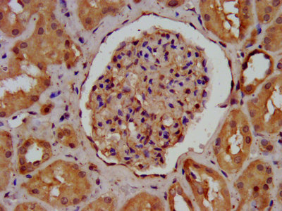 AGRN / Agrin Antibody - IHC image of AGRN Antibody diluted at 1:400 and staining in paraffin-embedded human kidney tissue performed on a Leica BondTM system. After dewaxing and hydration, antigen retrieval was mediated by high pressure in a citrate buffer (pH 6.0). Section was blocked with 10% normal goat serum 30min at RT. Then primary antibody (1% BSA) was incubated at 4°C overnight. The primary is detected by a biotinylated secondary antibody and visualized using an HRP conjugated SP system.