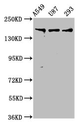 AGRN / Agrin Antibody - Western Blot Positive WB detected in: A549 whole cell lysate, U87 whole cell lysate, 293 whole cell lysate All lanes: AGRN antibody at 7.5µg/ml Secondary Goat polyclonal to rabbit IgG at 1/50000 dilution Predicted band size: 218, 206, 217, 215 kDa Observed band size: 218 kDa