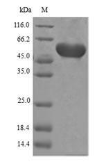 3-phosphoshikimate 1-carboxyvinyltransferase Protein - (Tris-Glycine gel) Discontinuous SDS-PAGE (reduced) with 5% enrichment gel and 15% separation gel.