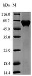 3-phosphoshikimate 1-carboxyvinyltransferase Protein - (Tris-Glycine gel) Discontinuous SDS-PAGE (reduced) with 5% enrichment gel and 15% separation gel.