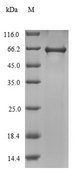virE2 Protein - (Tris-Glycine gel) Discontinuous SDS-PAGE (reduced) with 5% enrichment gel and 15% separation gel.