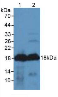 AGRP Antibody - Western Blot; Sample: Lane1: Mouse Heart Tissue; Lane2: Rat Heart Tissue.