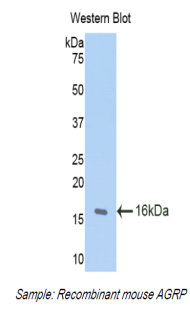 AGRP Antibody - Western blot of recombinant AGRP.  This image was taken for the unconjugated form of this product. Other forms have not been tested.