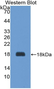 AGRP Antibody - Western Blot; Sample: Recombinant protein.