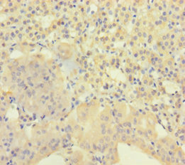 AGRP Antibody - Immunohistochemistry of paraffin-embedded human adrenal gland tissue at dilution 1:100