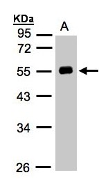 AGT / Angiotensinogen Antibody - Sample (30 ug whole cell lysate). A: Hep G2 . 10% SDS PAGE. Angiotensin II antibody diluted at 1:1000