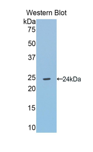 AGT / Angiotensinogen Antibody - Western blot of recombinant AGT / Angiotensinogen.  This image was taken for the unconjugated form of this product. Other forms have not been tested.